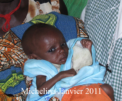 Enfants malnutris nord Bénin